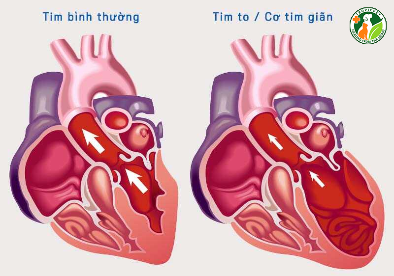 Bệnh tim to ở chó